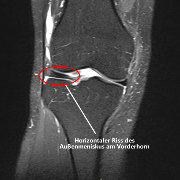 post_1201_aus_der_traum_gendarmstien_2025_4